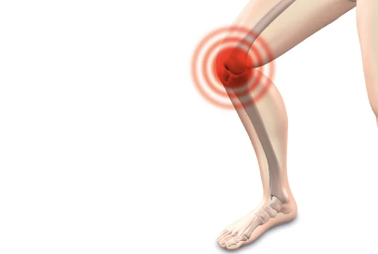 Bursitis: tratamiento con quiropraxia y terapias complementarias en Bogotá